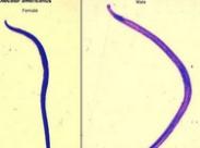 外陰蟯蟲(chóng)病