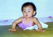 小兒頸交感神經(jīng)麻痹綜合征