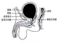 膀胱上內疝