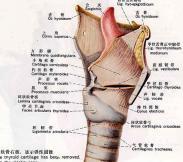 氣管腫瘤