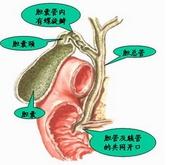 外傷性膽管損傷